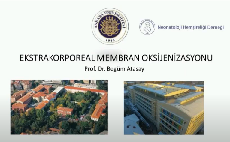 Kardiyovasküler Hasta Takibi ve ECMO Tedavisi